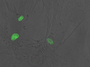 Aged human cells showing abnormal folding of the nuclear envelope