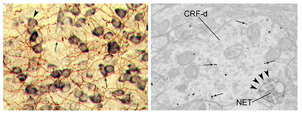 CRF-d NET image from the Van Bockstaele Lab.