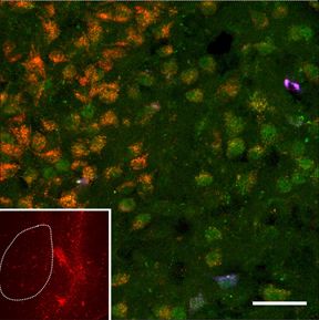 Image of Jessica Barson's research into the neurobiology of addicition