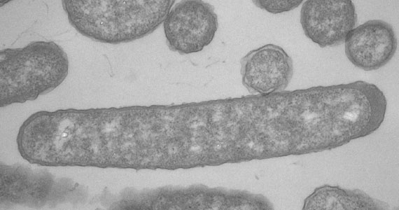 Transmission electron micrograph of cultured Pseudomonas-like bacteria, symbiotic residents of Cephalotes ants for over 40 million years. Photo credit: John Wertz.