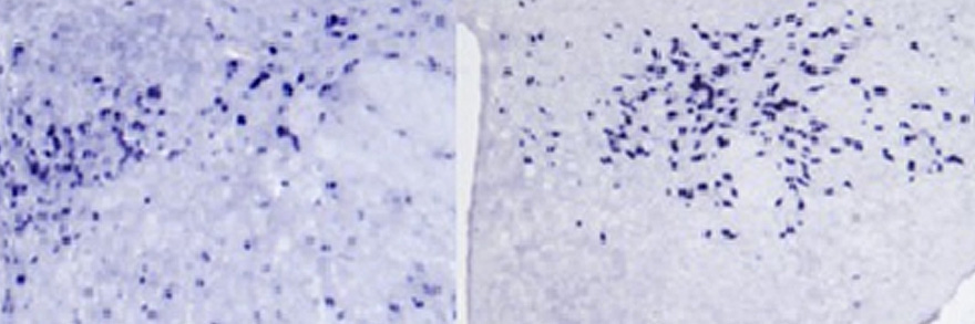 Neuropeptide disturbances images from the Barson Lab at Drexel University College of Medicine.