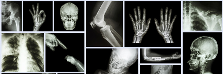 A collection of x-ray images, multiple parts of a human.