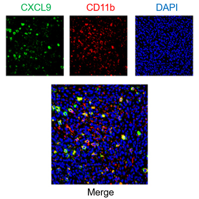 Multiplex staining of immune cells and chemokines in mouse tumor samples. Source: Romano Lab