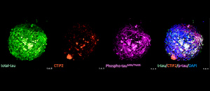 Representative whole mount immunostaining images of assembloids with phenotypes and morphologies relevant to the study of frontotemporal demnetia. Source: Liang Qiang Lab.