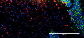 Molecular Basis of Cancer