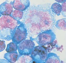 2014 International Symposium on Molecular Medicine and Infectious Disease
