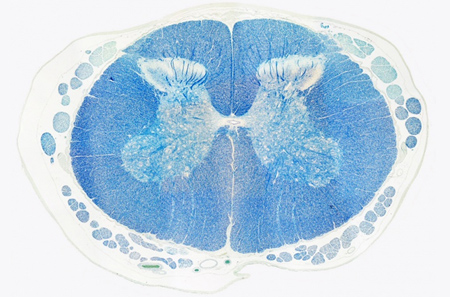 Drexel Histotechnology program image - Luxol Fast Blue Stain, Spinal Cord.