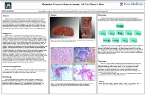 Pathologists' Assistant Research: Metastatic Prostate Adenocarcinoma
