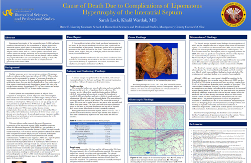 Cause of Death Due to Complications of Lipomatous Hypertrophy of the Interatrial Septum