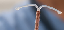 Doctor holding T-shaped intrauterine birth control device.