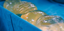 Silicone Implants